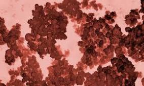 Laboratorio Chileno crea Desinfectante con nanopart&iacute;culas de Cobre para atacar el Covid-19